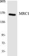 Mannose Receptor C-Type 1 antibody, LS-C200207, Lifespan Biosciences, Western Blot image 