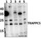 Trafficking Protein Particle Complex 5 antibody, A15594, Boster Biological Technology, Western Blot image 