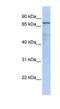 Guanine Monophosphate Synthase antibody, NBP1-52972, Novus Biologicals, Western Blot image 