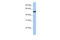 Solute Carrier Family 38 Member 9 antibody, 26-766, ProSci, Enzyme Linked Immunosorbent Assay image 