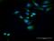 Homer Scaffold Protein 2 antibody, H00009455-D01P, Novus Biologicals, Immunofluorescence image 