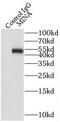 MDIG antibody, FNab05190, FineTest, Immunoprecipitation image 