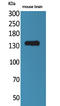 Contactin 1 antibody, STJ96487, St John