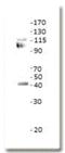 Tyrosyl-DNA Phosphodiesterase 2 antibody, NBP2-11492, Novus Biologicals, Western Blot image 