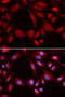 Proteasome 26S Subunit, Non-ATPase 7 antibody, A09527, Boster Biological Technology, Western Blot image 