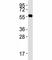 Protein Arginine Methyltransferase 3 antibody, F40449-0.4ML, NSJ Bioreagents, Western Blot image 