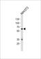 Neurotrophic Receptor Tyrosine Kinase 2 antibody, LS-C164509, Lifespan Biosciences, Western Blot image 
