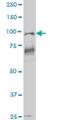 Vav Guanine Nucleotide Exchange Factor 1 antibody, H00007409-M02, Novus Biologicals, Western Blot image 