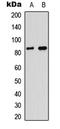 Myeloperoxidase antibody, LS-C354482, Lifespan Biosciences, Western Blot image 