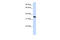 Developmental pluripotency-associated protein 2 antibody, 26-671, ProSci, Enzyme Linked Immunosorbent Assay image 