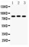 Transient Receptor Potential Cation Channel Subfamily V Member 6 antibody, PA1980, Boster Biological Technology, Western Blot image 