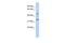 Cyclin Y Like 1 antibody, GTX45647, GeneTex, Western Blot image 