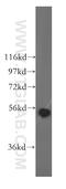 Aldehyde Dehydrogenase 1 Family Member B1 antibody, 15560-1-AP, Proteintech Group, Western Blot image 