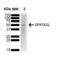 Gamma-Aminobutyric Acid Type A Receptor Alpha2 Subunit antibody, SMC-486D-A655, StressMarq, Western Blot image 