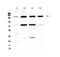 Integrin Subunit Alpha 5 antibody, PA5-79529, Invitrogen Antibodies, Western Blot image 