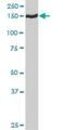 Trafficking Protein Particle Complex 10 antibody, H00007109-D01P, Novus Biologicals, Western Blot image 