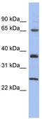 HORMA Domain Containing 2 antibody, TA338866, Origene, Western Blot image 