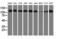 Histone Deacetylase 6 antibody, GTX84379, GeneTex, Western Blot image 