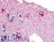 Glycogen Phosphorylase B antibody, LS-A2923, Lifespan Biosciences, Immunohistochemistry paraffin image 