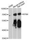 Netrin-4 antibody, LS-C748800, Lifespan Biosciences, Western Blot image 