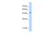 SERPINE1 MRNA Binding Protein 1 antibody, GTX47406, GeneTex, Western Blot image 