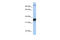 Kinesin Family Member C3 antibody, 25-168, ProSci, Enzyme Linked Immunosorbent Assay image 