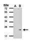 Glutathione Peroxidase 7 antibody, orb69849, Biorbyt, Western Blot image 