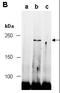 Tet Methylcytosine Dioxygenase 2 antibody, orb66693, Biorbyt, Immunoprecipitation image 
