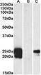 WAP Four-Disulfide Core Domain 2 antibody, orb20536, Biorbyt, Western Blot image 
