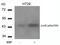JunB Proto-Oncogene, AP-1 Transcription Factor Subunit antibody, PA5-37620, Invitrogen Antibodies, Western Blot image 