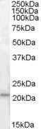 Mesencephalic Astrocyte Derived Neurotrophic Factor antibody, GTX88900, GeneTex, Western Blot image 