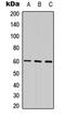 Frizzled Class Receptor 4 antibody, LS-C354378, Lifespan Biosciences, Western Blot image 