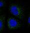 Collagen Type VIII Alpha 1 Chain antibody, NBP2-13856, Novus Biologicals, Immunofluorescence image 