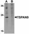 Tetraspanin 9 antibody, orb94356, Biorbyt, Western Blot image 