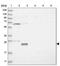 Ubiquitin Conjugating Enzyme E2 E2 antibody, PA5-55996, Invitrogen Antibodies, Western Blot image 