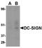 CD209 Molecule antibody, LS-B14745, Lifespan Biosciences, Western Blot image 
