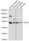 ETS Variant 6 antibody, 16-576, ProSci, Western Blot image 