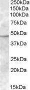 Transmembrane protease serine 4 antibody, GTX88636, GeneTex, Western Blot image 