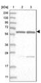 Splicing Factor 3a Subunit 3 antibody, PA5-56909, Invitrogen Antibodies, Western Blot image 