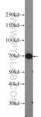 PML-RARA Regulated Adaptor Molecule 1 antibody, 13651-1-AP, Proteintech Group, Western Blot image 