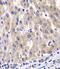 Ribosomal Protein L14 antibody, FNab07414, FineTest, Immunohistochemistry paraffin image 