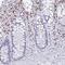 RUNX Family Transcription Factor 2 antibody, NBP1-89104, Novus Biologicals, Immunohistochemistry paraffin image 