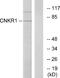 Connector enhancer of kinase suppressor of ras 1 antibody, A30546, Boster Biological Technology, Western Blot image 