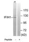 Interferon Induced With Helicase C Domain 1 antibody, MBS002826, MyBioSource, Western Blot image 