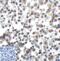 T Cell Immunoreceptor With Ig And ITIM Domains antibody, RF16055, ProSci, Immunohistochemistry frozen image 