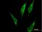 Phenylalanyl-TRNA Synthetase Subunit Alpha antibody, H00002193-B01P, Novus Biologicals, Immunocytochemistry image 