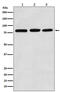 Phosphoinositide-3-Kinase Regulatory Subunit 1 antibody, M00318-2, Boster Biological Technology, Western Blot image 