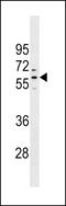 PRAME Family Member 1 antibody, LS-C158722, Lifespan Biosciences, Western Blot image 