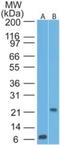 CD69 Molecule antibody, NBP2-25242, Novus Biologicals, Western Blot image 