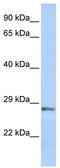 Secreted Frizzled Related Protein 2 antibody, TA342204, Origene, Western Blot image 